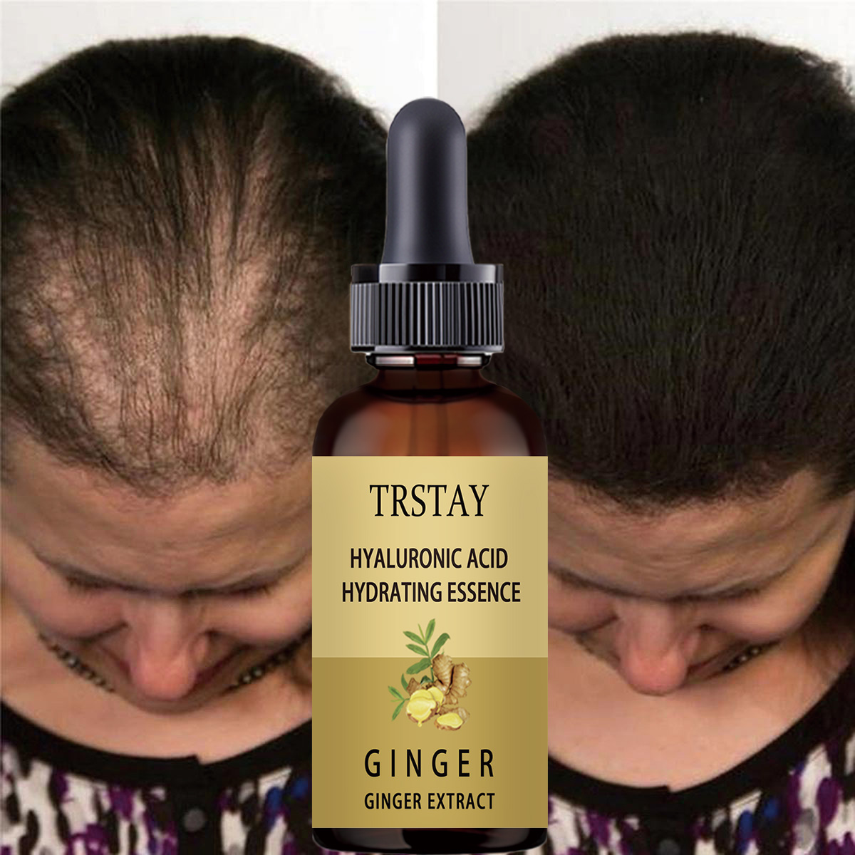 Caffeine Hair Serum - Siero per la crescita dei capelli