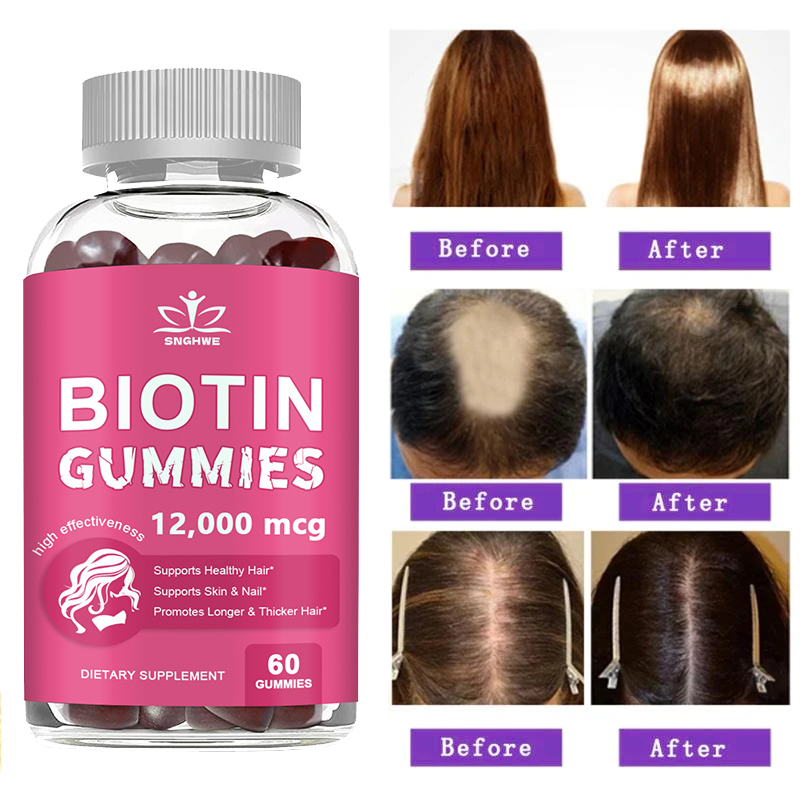 Hair Care Gummies - Caramelle gommose al collagene Caramelle alla