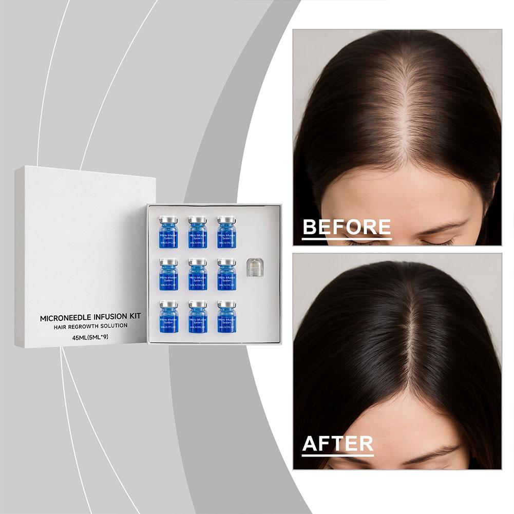 Hair Care Oil Serum - Set di Micro-Aghi con Siero Essenziale