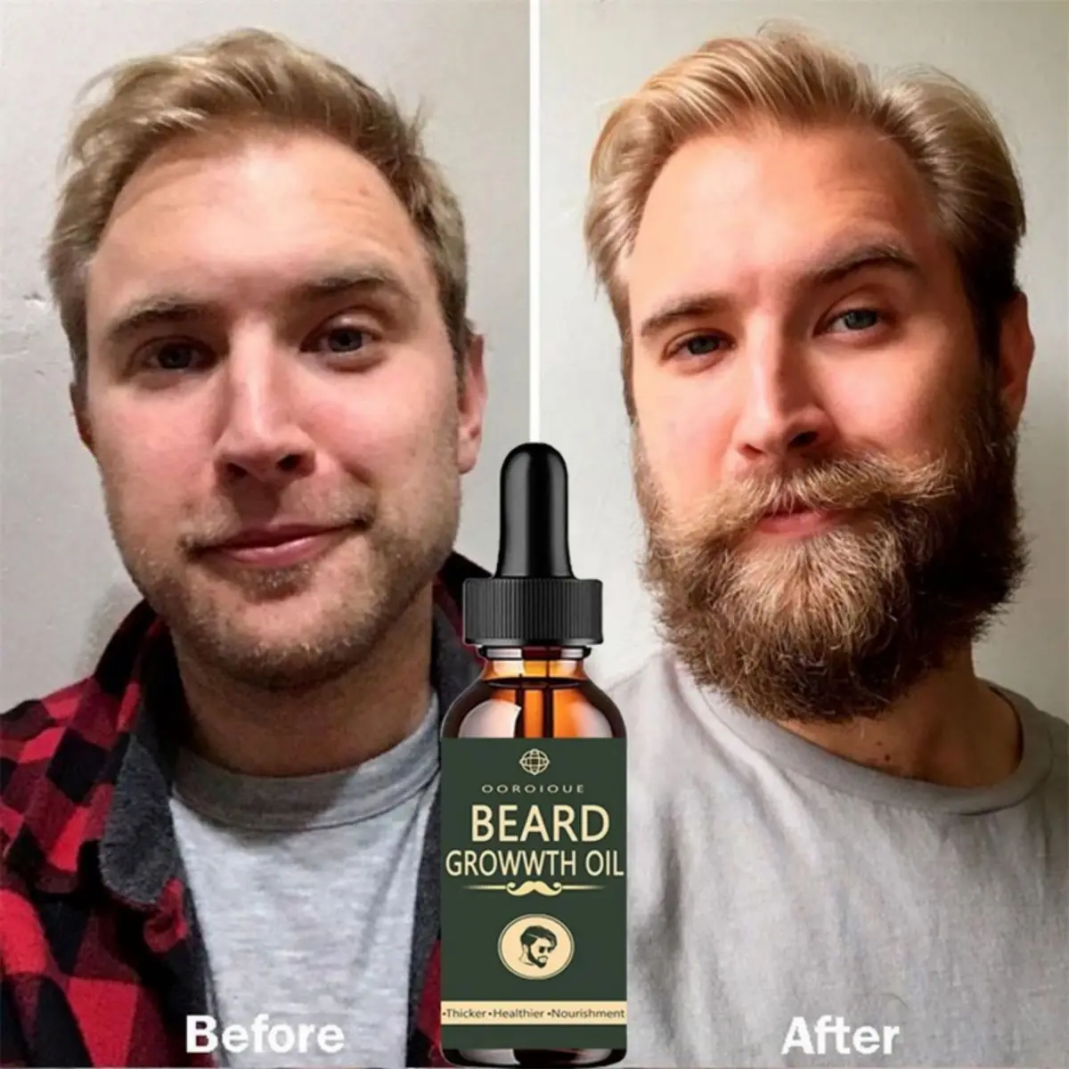 Caffeine Hair Serum - Olio per la crescita rapida della