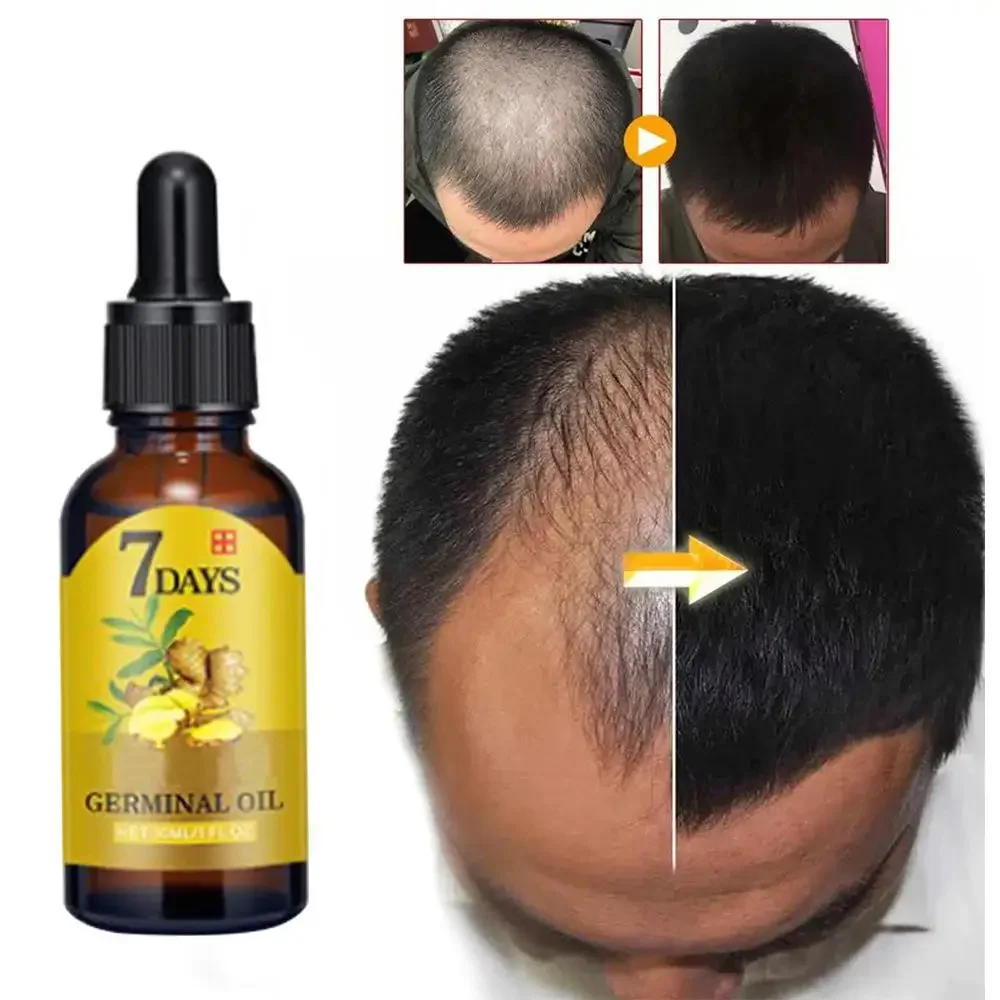 Hair Care Essence Oil Spray - Crescita dei capelli Zenzero Capelli a