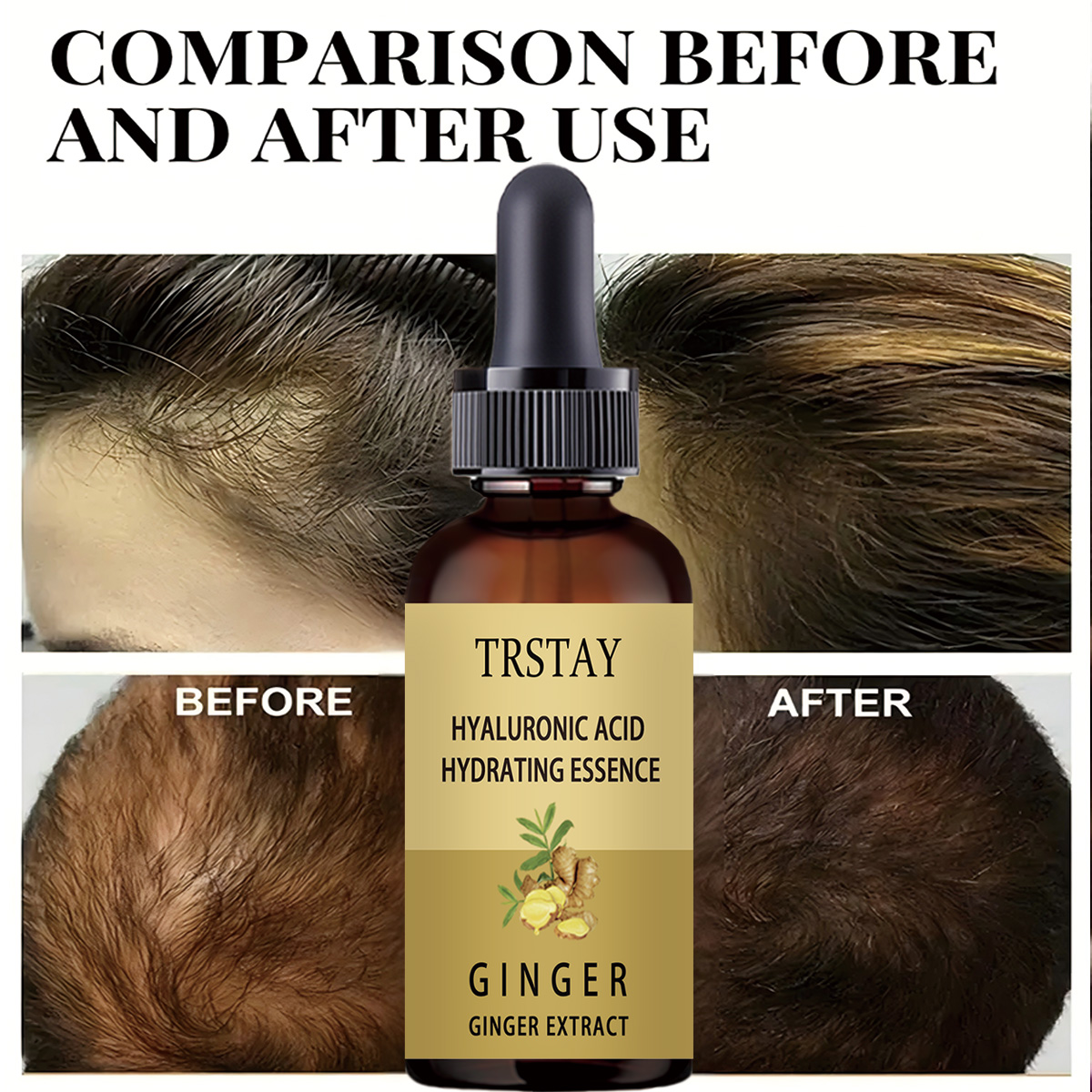 Siero per la crescita dei cape - Caffeine Hair Serum recensione e prezzo