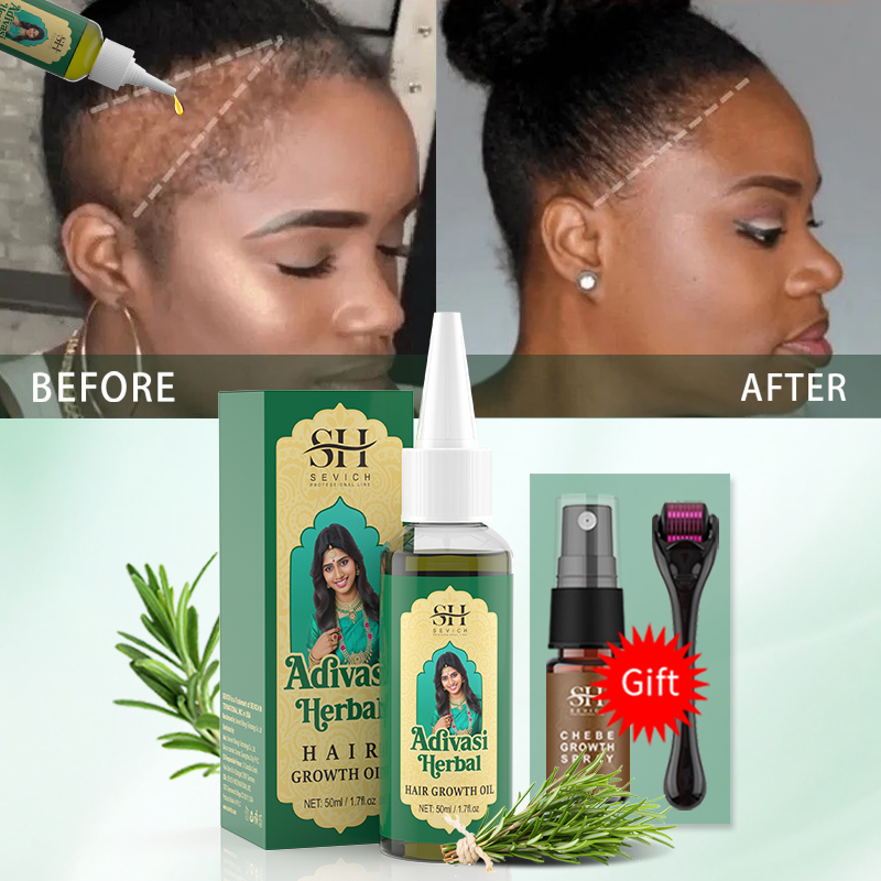 Olio Ayurvedico per la Crescit - Hair Care Essence Oil Spray recensione e prezzo