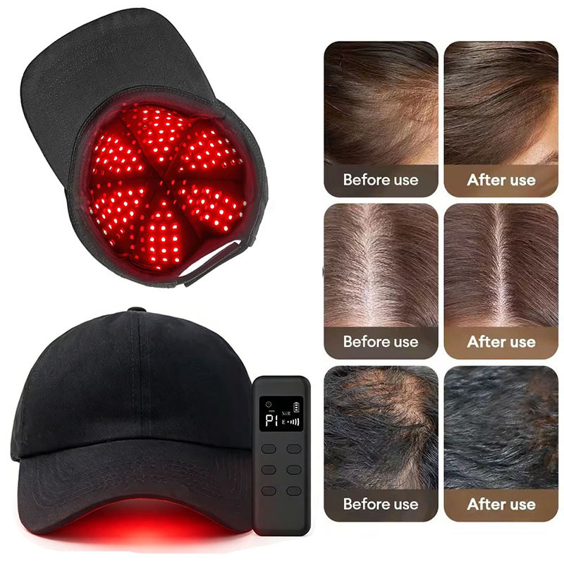 Cappello Portatile per Terapia - Hair Care Wella recensione e prezzo