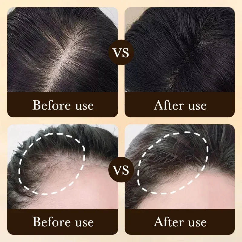 Olio per Crescita Rapida dei C - Hair Care Essence Oil Spray recensione e prezzo