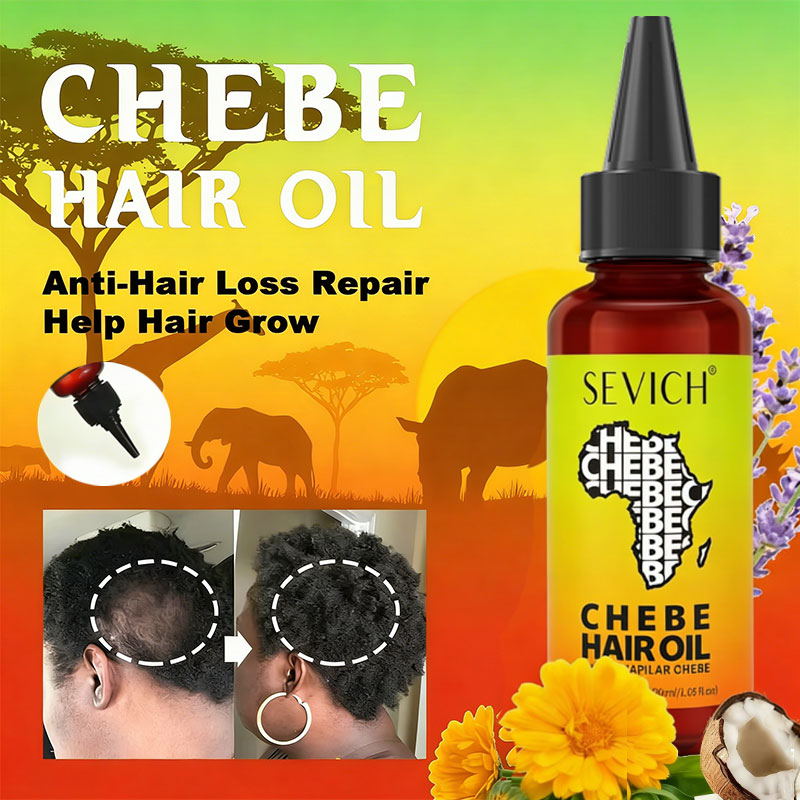 Olio Chebe per Crescita Rapida - Hair Care Essence Oil Spray recensione e prezzo