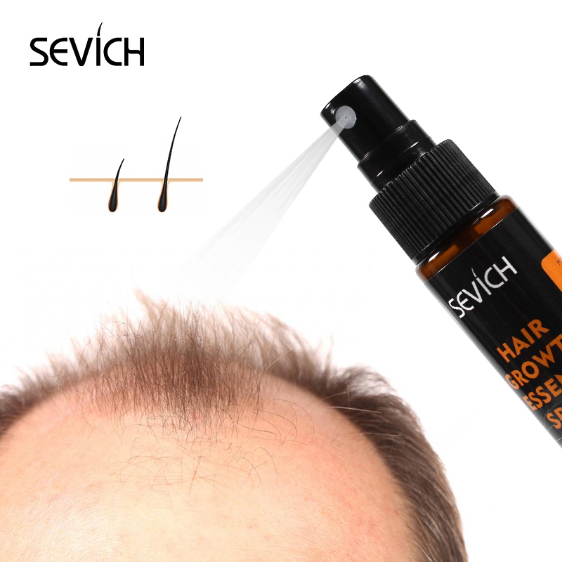 Sevich 30ml Hebal Oil Essence  - Hair Care Essence Oil Spray recensione e prezzo